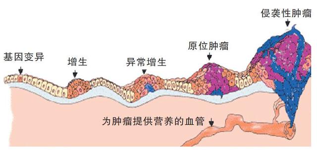 想知道自己身体是否有癌怎么检查,怀疑患了肿瘤怎么筛查最好