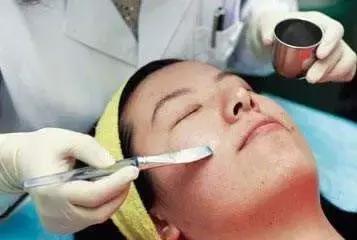 12岁孩子脸上黑头粉刺如何处理,脸上的黑头粉刺如何才能彻底去除