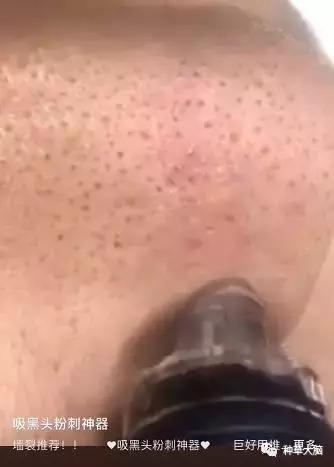 美容仪器小气泡有什么用,美容院小气泡仪器新款