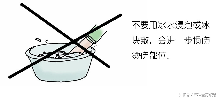 小孩烫伤了怎么处理好得快,热水烫伤怎么处理最快最好