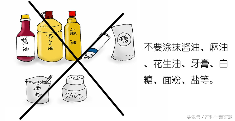 小孩烫伤了怎么处理好得快,热水烫伤怎么处理最快最好