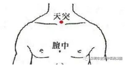 中医如何调理小儿过敏性咳嗽,中医小儿过敏性咳嗽怎么调理