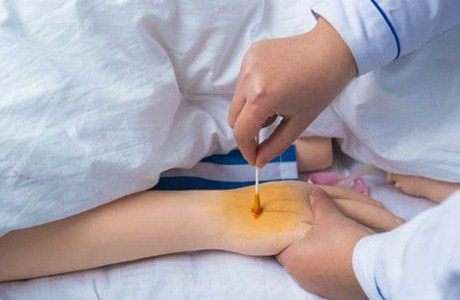 胃癌晚期一线免疫疗法,学医女孩胃癌