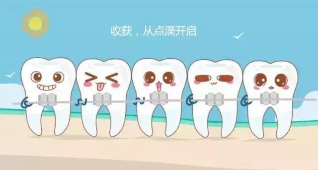 戴牙套如何清洁,牙套的清洁推荐