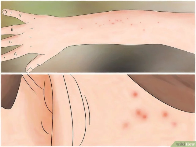 如何清除床虱,广东床虱怎么清除