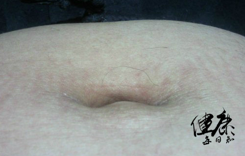 肚脐形状看健康图片全图,肚脐形状看身材