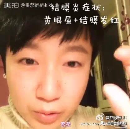 宝宝眼睛黄色眼屎导致眼睛发红,宝宝眼睛眼屎多黄稠怎么解决