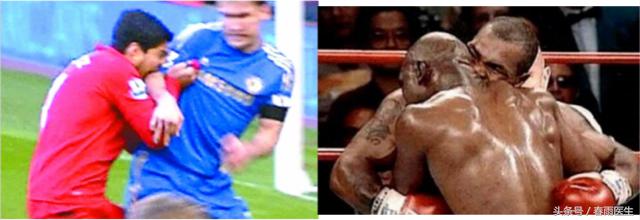 被狗咬了打了狂犬病疫苗会有事吗,被狗咬后狂犬疫苗只打一针可以吗