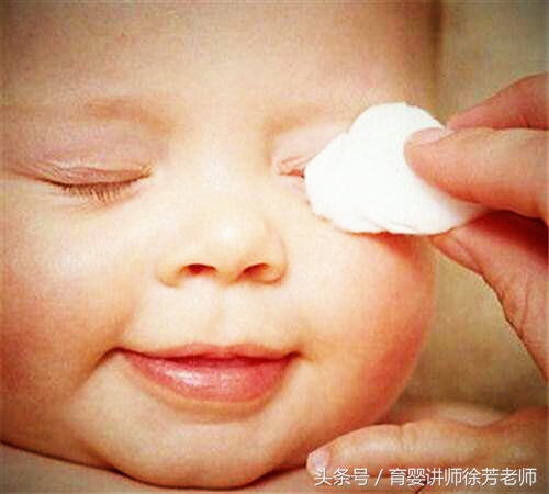 宝宝眼屎多是上火吗,宝宝眼屎多就是上火
