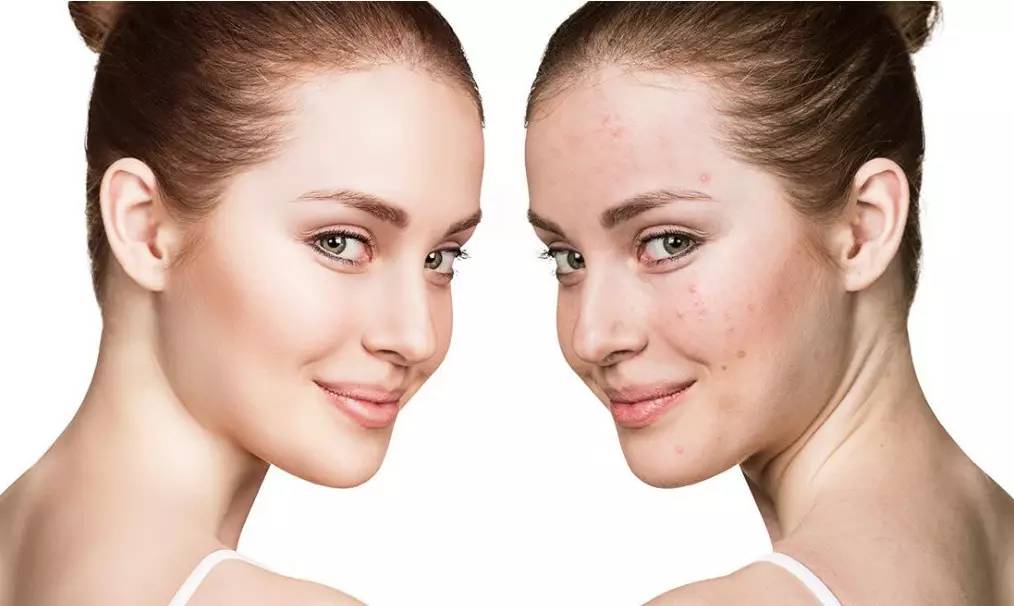 护肤避雷第一步学会辨别自己肤质,护肤第一步如何正确认清自己肤质