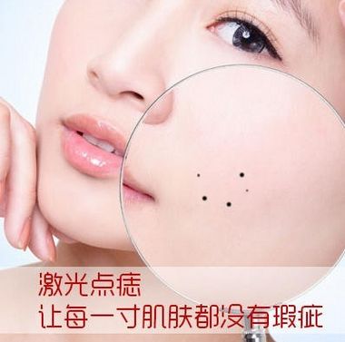 一女子回顾在美容院祛斑有多坑,女子点痣后查出恶性肿瘤