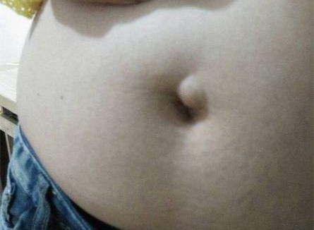 腹部有个小疙瘩要不要做手术,腹部恶性包块有转移可以切除吗