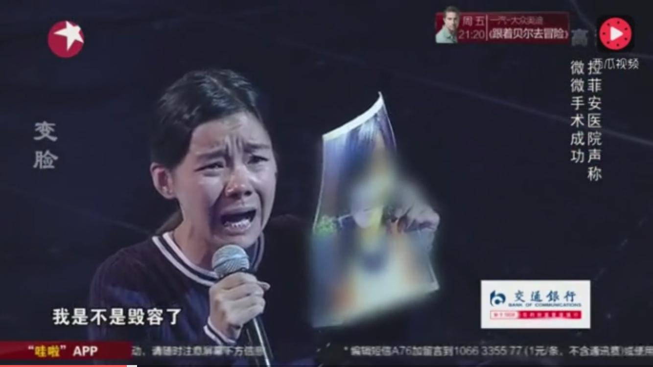 盘点一下韩国整形失败,韩国整形最难做的手术