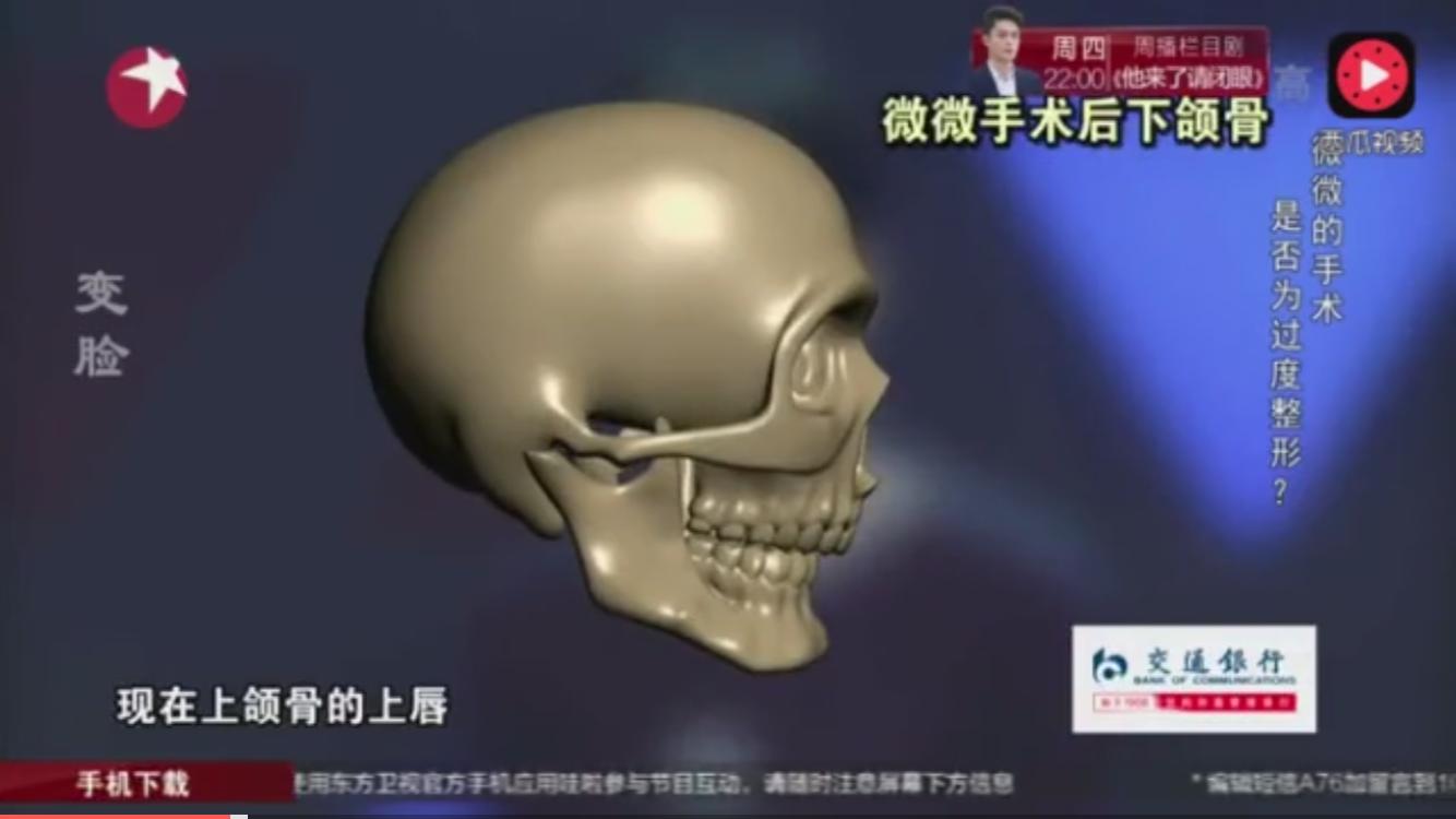 盘点一下韩国整形失败,韩国整形最难做的手术