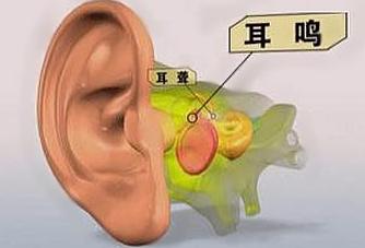 这些方子值得为家人收藏,脑白金的最佳配方