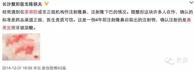 远离整形美容四大误区,手把手教你避开整形陷阱