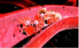 血管老化快寿命就短吗,血管特别细寿命就会短吗