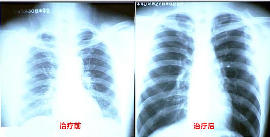 北京丰台区华康中医医院,北京中医院治疗哮喘怎么样