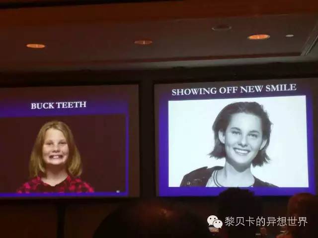 她们说||那些年整牙吞下的血和泪，终于换来最开怀的大笑