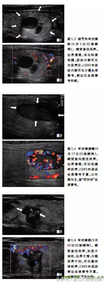 查出甲状腺结节要不要赶紧治疗,甲状腺结节多大范围不需要治疗