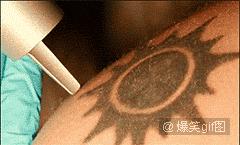 这样的文身，女孩涂后红疹起泡留疤都来了，你还敢玩吗？