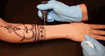 女子洗纹身后破溃化脓了,纹身烫伤起泡会留疤吗