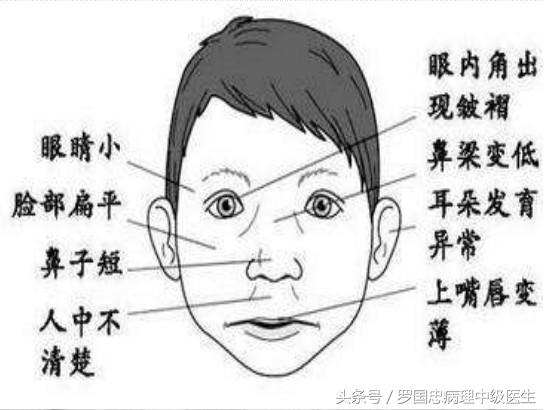 男人酒后导致怀孕对宝宝有影响吗,老公酒后怀孕对胎儿有没有影响