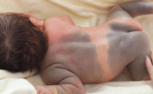 孕妇胎儿胎位不正是怎么办,37周加胎儿未入盆一般几周会入盆