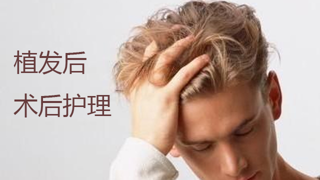涨点姿势！做完植发，效果能维持时间？