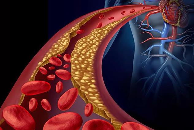 就医搜｜每10人中就有1人中招！高尿酸血症真的与你无关？
