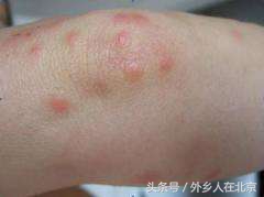 出租屋有很小的虫子是什么原因,新入住的房子里有小虫子