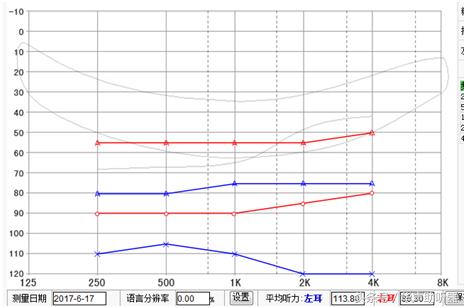 黄石验配助听器,黄石助听器质量推荐