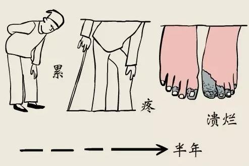 男子抽20年烟三根脚趾坏死,男子抽烟20年脚趾坏死