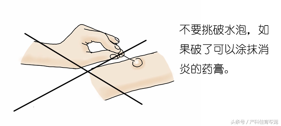 小孩烫伤了怎么处理好得快,热水烫伤怎么处理最快最好