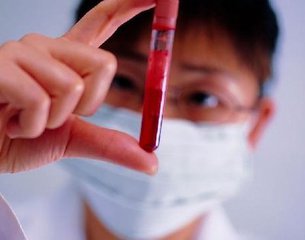 肾病复发几次就会肾衰竭与尿毒症,专治肾病的6大技巧