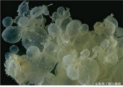 怀孕五月却检查出葡萄胎，这种心痛有谁能懂？