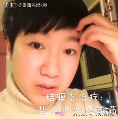 宝宝眼睛黄色眼屎导致眼睛发红,宝宝眼睛眼屎多黄稠怎么解决