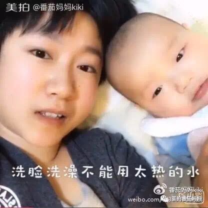 幼儿头垢和湿疹结痂的区别,湿疹洗澡用什么清洗