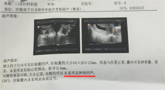 怀孕两次都不发育怎么回事,两次hcg不翻倍导致胎停咋回事