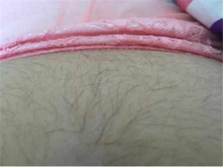 怀孕长毛是什么原因,怀孕长毛是怀的儿子吗