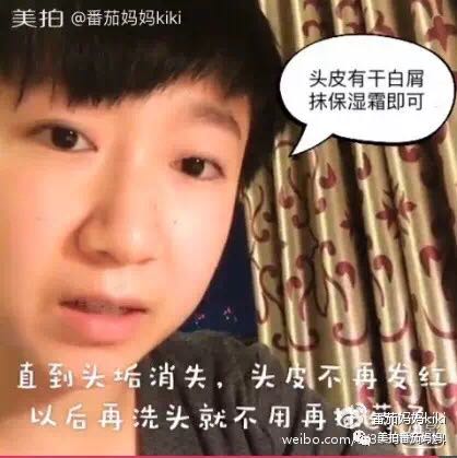 幼儿头垢和湿疹结痂的区别,湿疹洗澡用什么清洗
