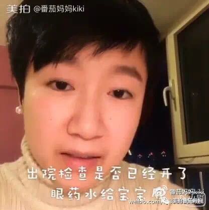 宝宝眼睛黄色眼屎导致眼睛发红,宝宝眼睛眼屎多黄稠怎么解决