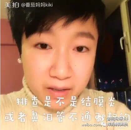 宝宝眼睛黄色眼屎导致眼睛发红,宝宝眼睛眼屎多黄稠怎么解决