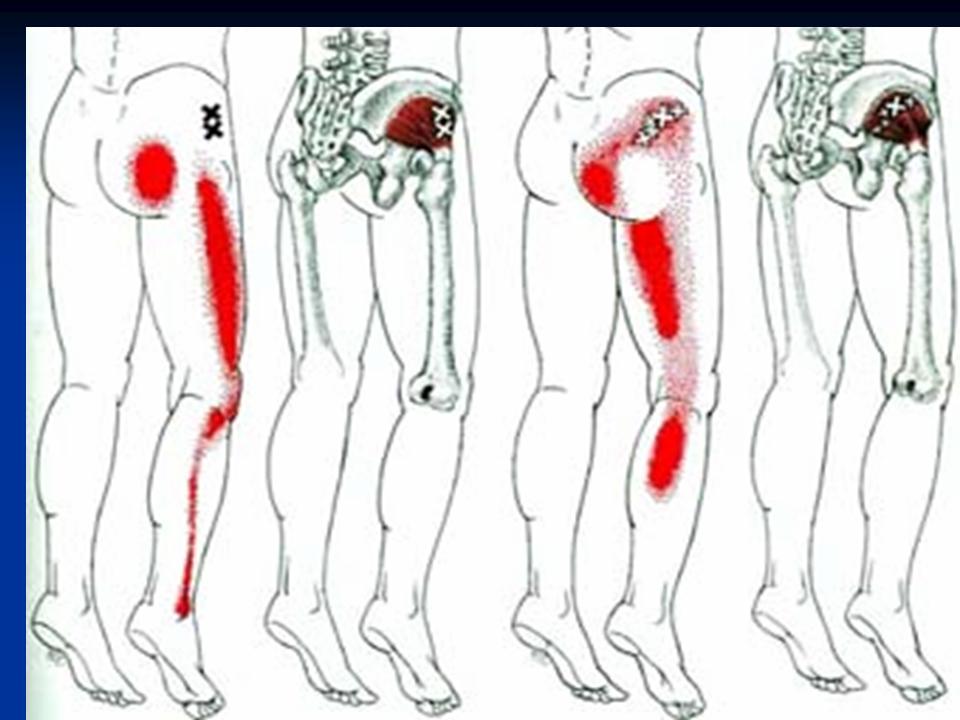 膝关节骨性关节炎的阶梯治疗课件,膝关节炎的非手术疗法