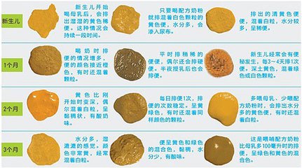 新生儿出生15天正常的大便次数,新生儿满月后大便次数减少