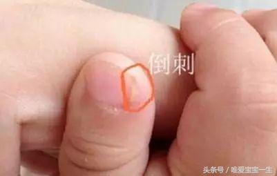 宝宝缺锌需要做哪些检查,一岁三个月宝宝缺锌自测表