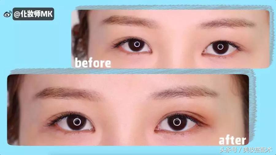 细长双眼皮贴小内双教程,最全双眼皮贴教程
