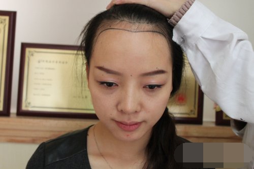 发问｜植发是选择植发机构还是三甲医院？