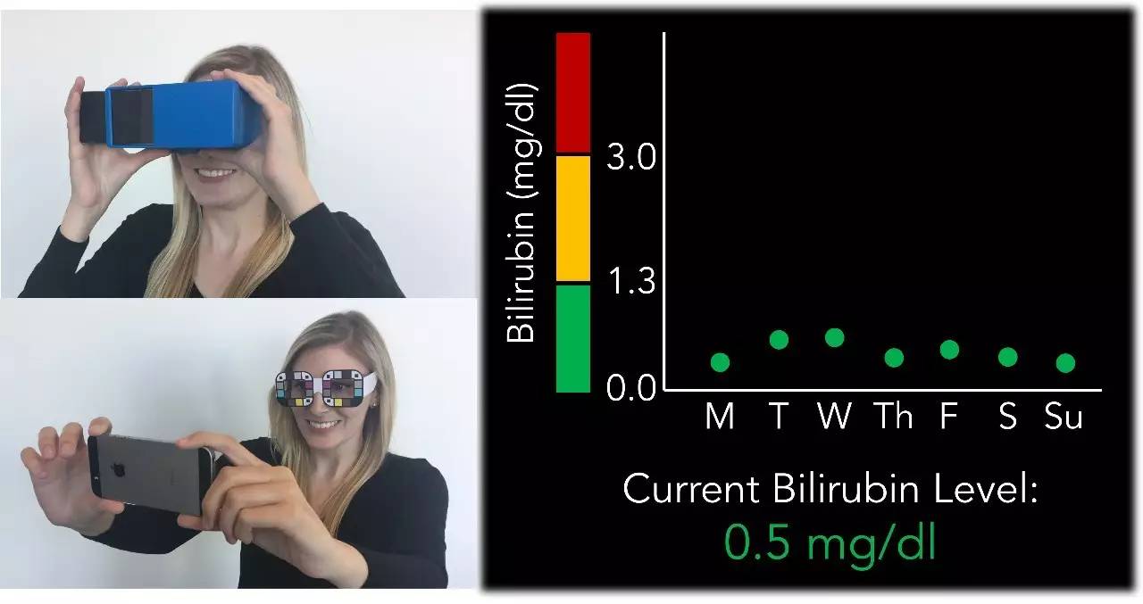 美国华盛顿大学开发出新款APP：通过智能手机自拍筛查胰腺癌！