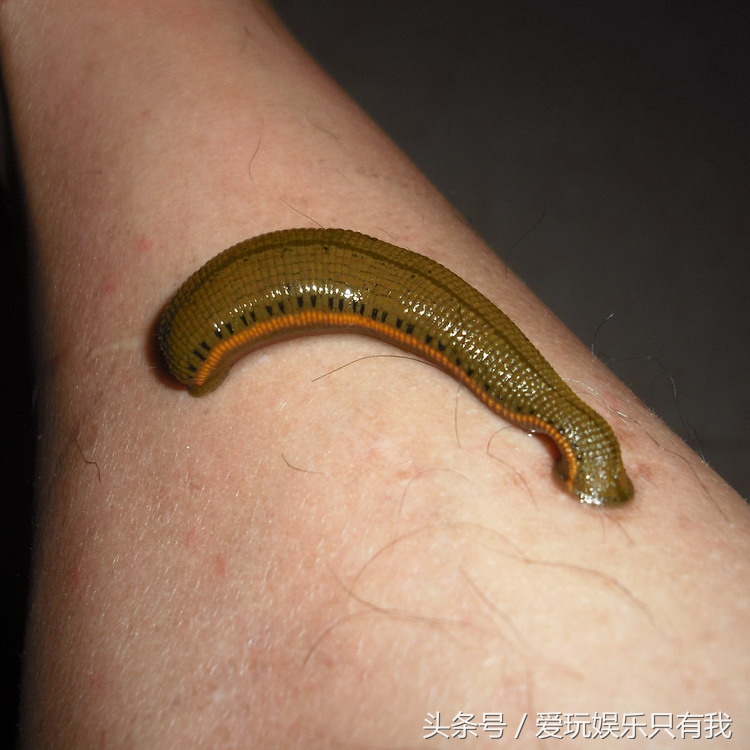 怎么预防干蚂蟥上身,野游被蚂蟥上身